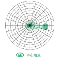 中心暗点